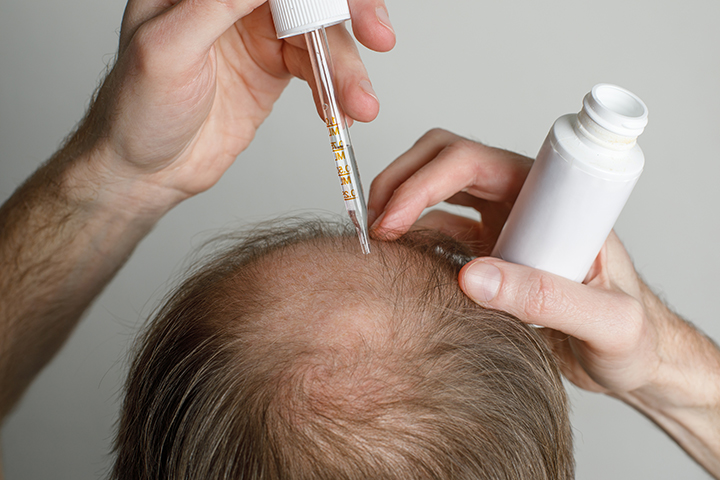 Hair loss